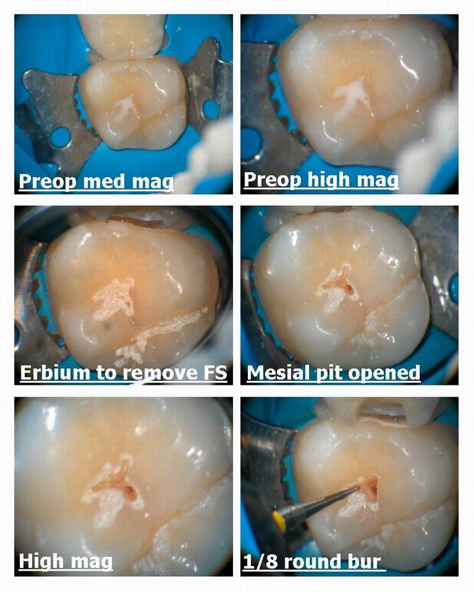 Resize of Microdental bubble in FS pg 1.jpg